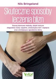 skuteczne-sposoby-leczenia-blizn-nils-bringeland